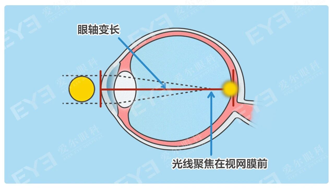 8aab0e2c-a025-44ee-b4e8-7d97dd1515ad 8aab0e2c-a025-44ee-b4e8-7d97dd1515ad